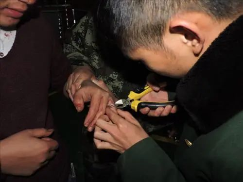 戒指竟是最危险的首饰?又有人为它破财伤身,差点手都“废”了…